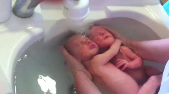 Удивительные кадры близнецов которые еще не поняли, что родились..)