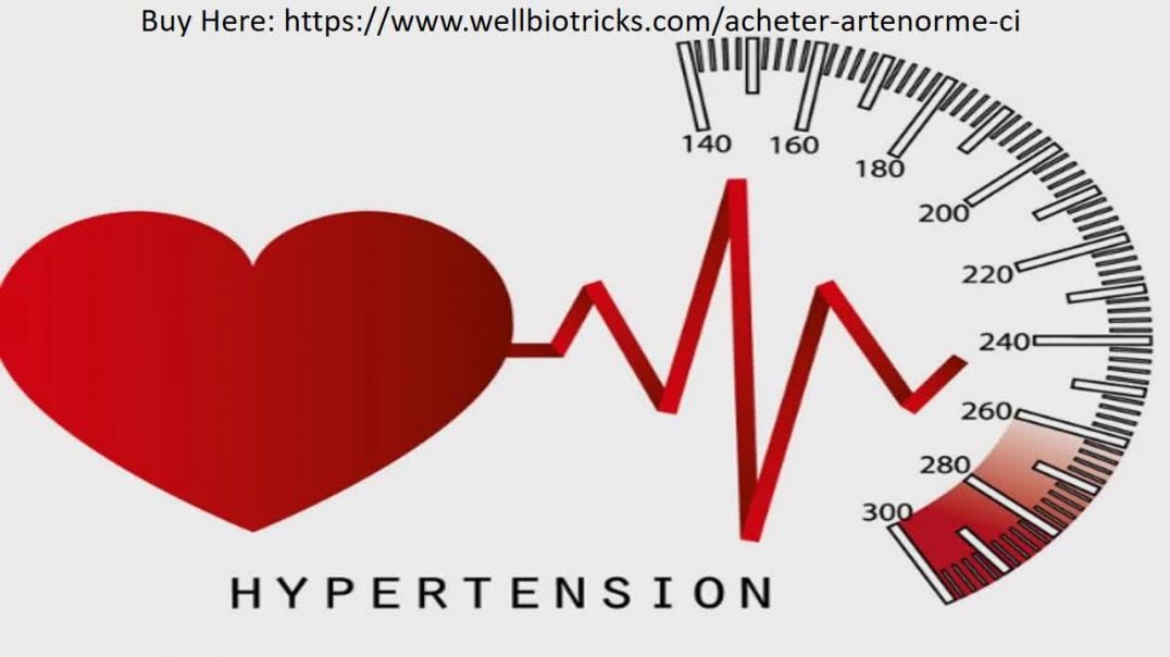 Artenorme: Méthodes de prévention de l'hypertension ! Avis, coût? (Côte d’Ivoire)